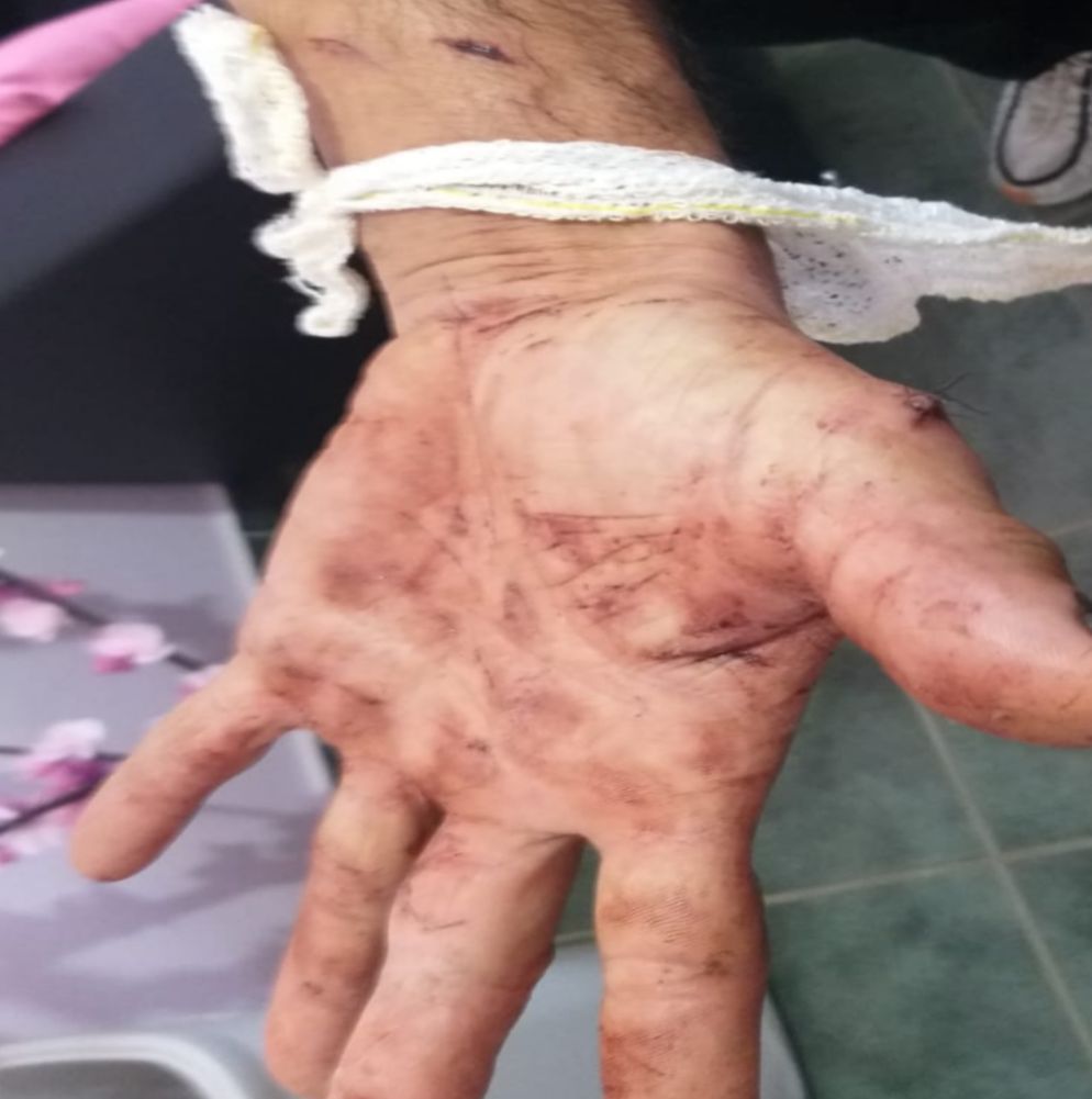 Homem denuncia tentativa de homicídio após agressão com faca em Paraibuna